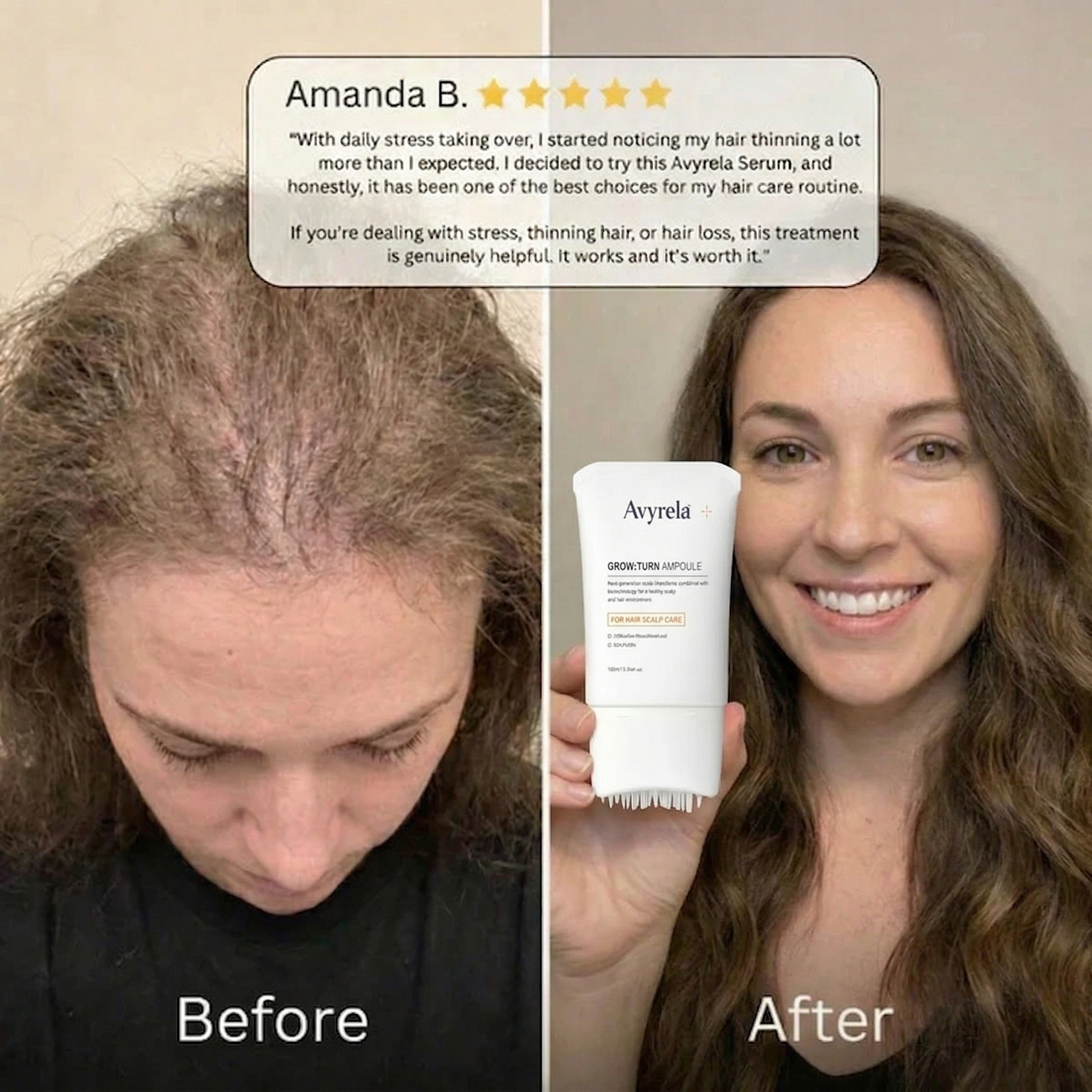 Avyrela Hair Growth Serum