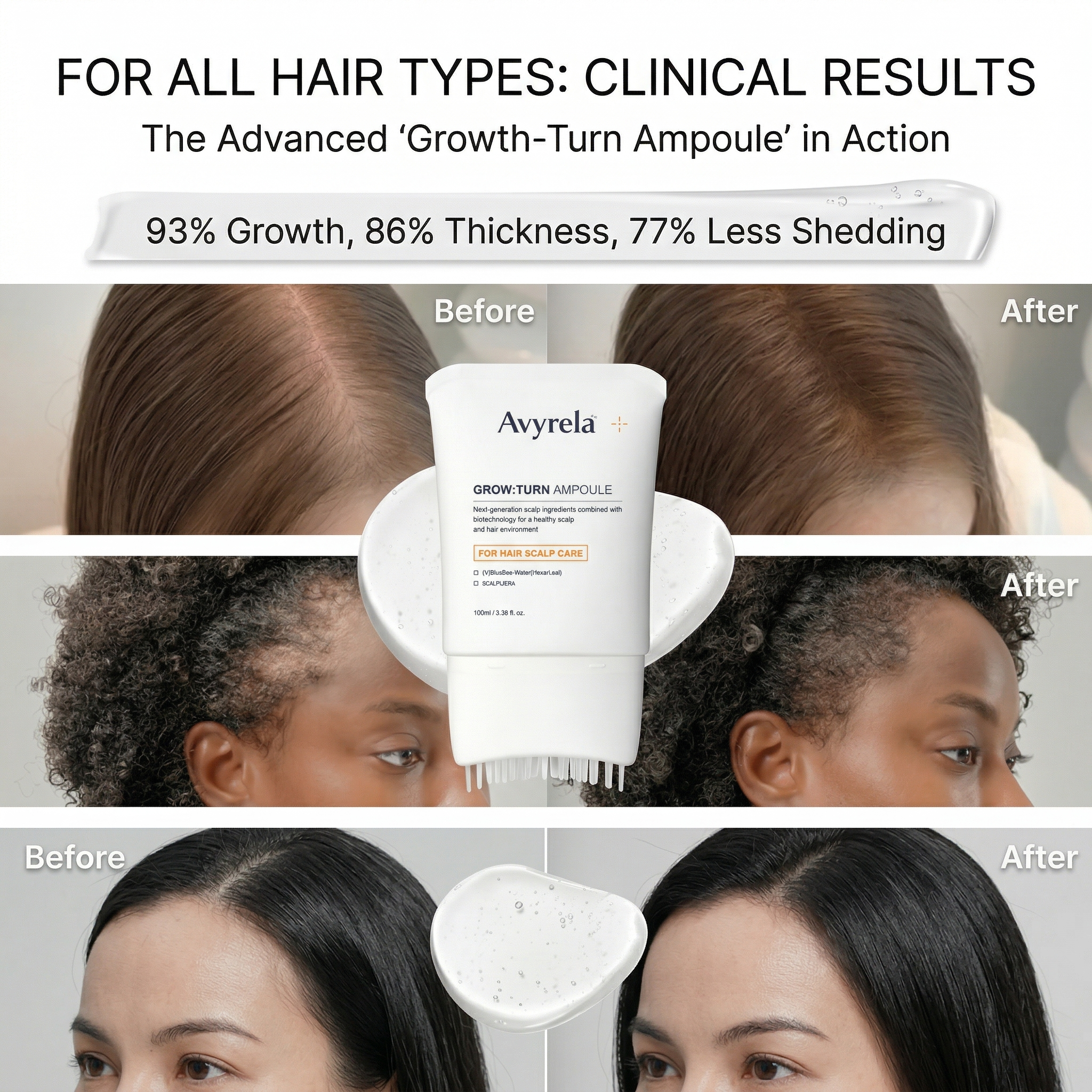 Avyrela Hair Growth Serum