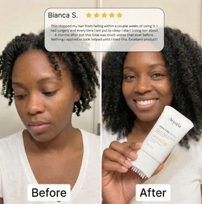 Avyrela Hair Growth Serum