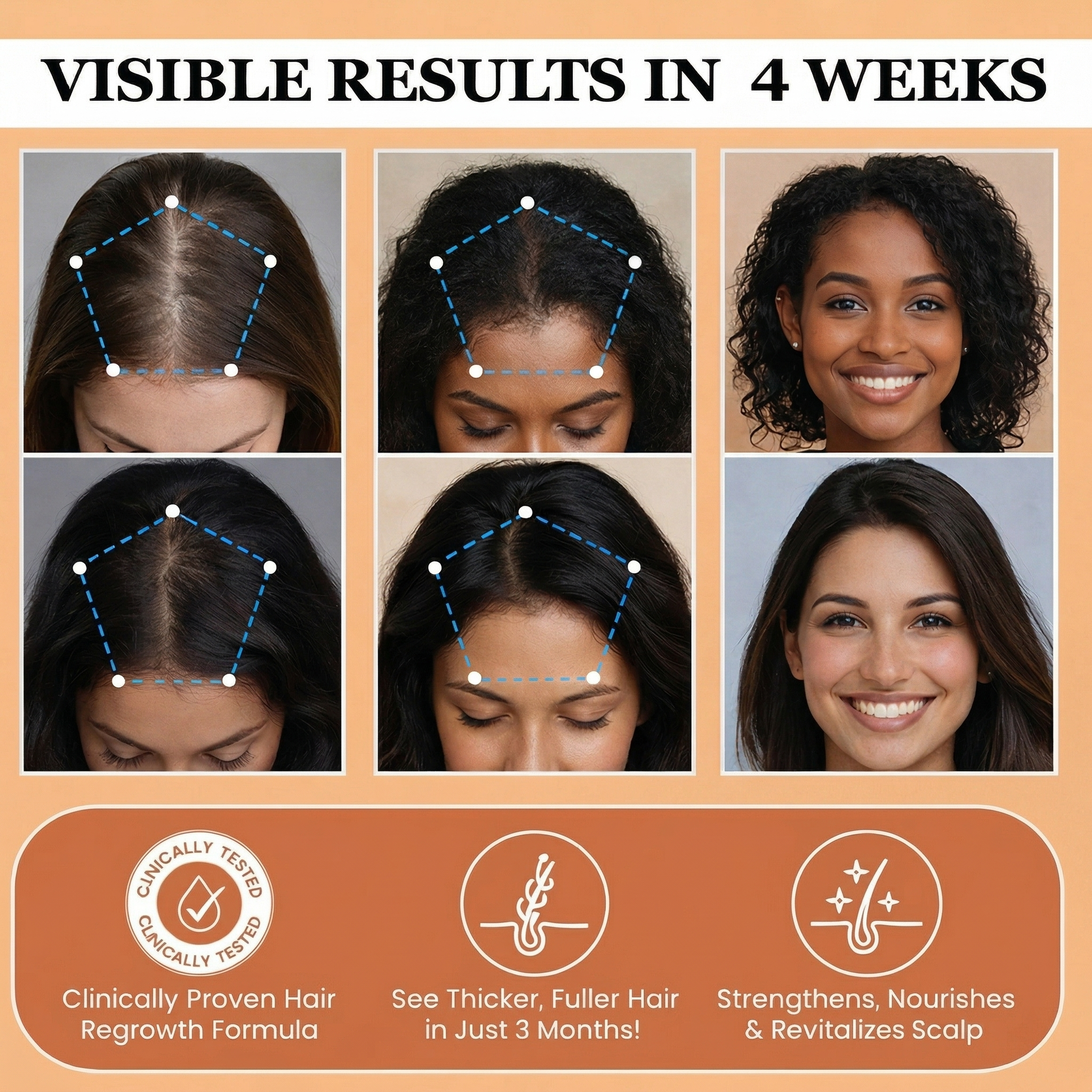 Avyrela Hair Growth Serum