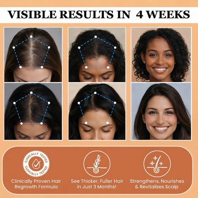 Avyrela Hair Growth Serum